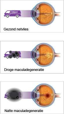 AMD_Types_object_003